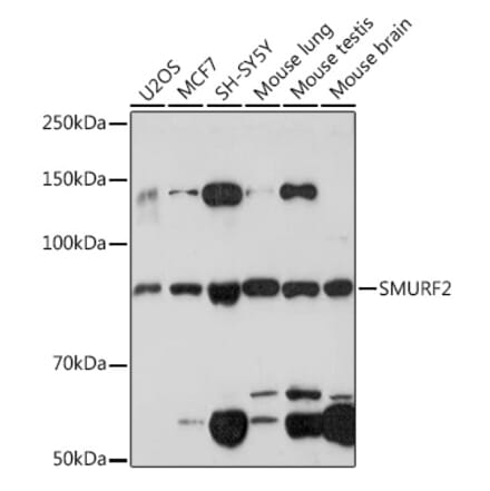 Western Blot - Anti-SMURF 2 Antibody [ARC1897] (A308190) - Antibodies.com