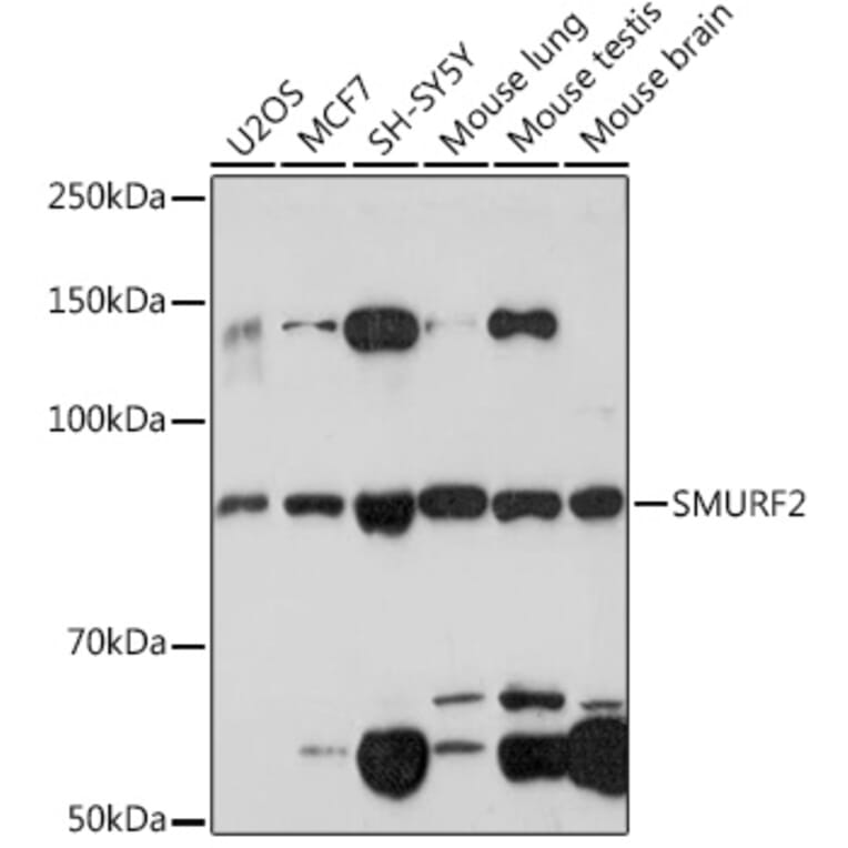 Western Blot - Anti-SMURF 2 Antibody [ARC1897] (A308190) - Antibodies.com