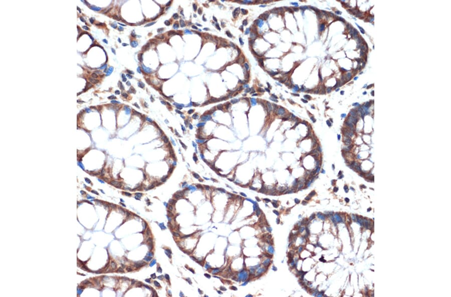 Immunohistochemistry - Anti-SMURF 2 Antibody [ARC1897] (A308190) - Antibodies.com