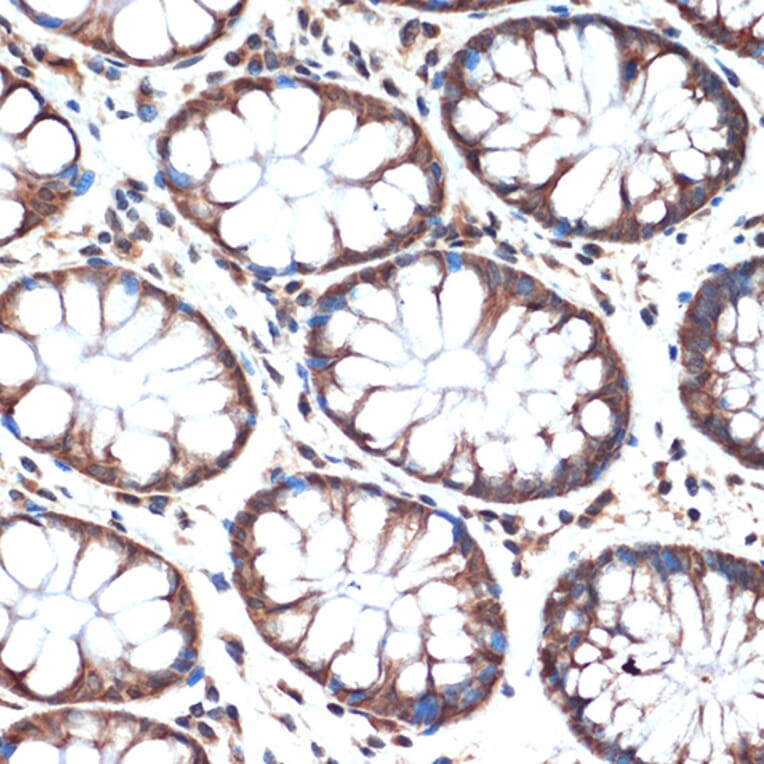 Immunohistochemistry - Anti-SMURF 2 Antibody [ARC1897] (A308190) - Antibodies.com