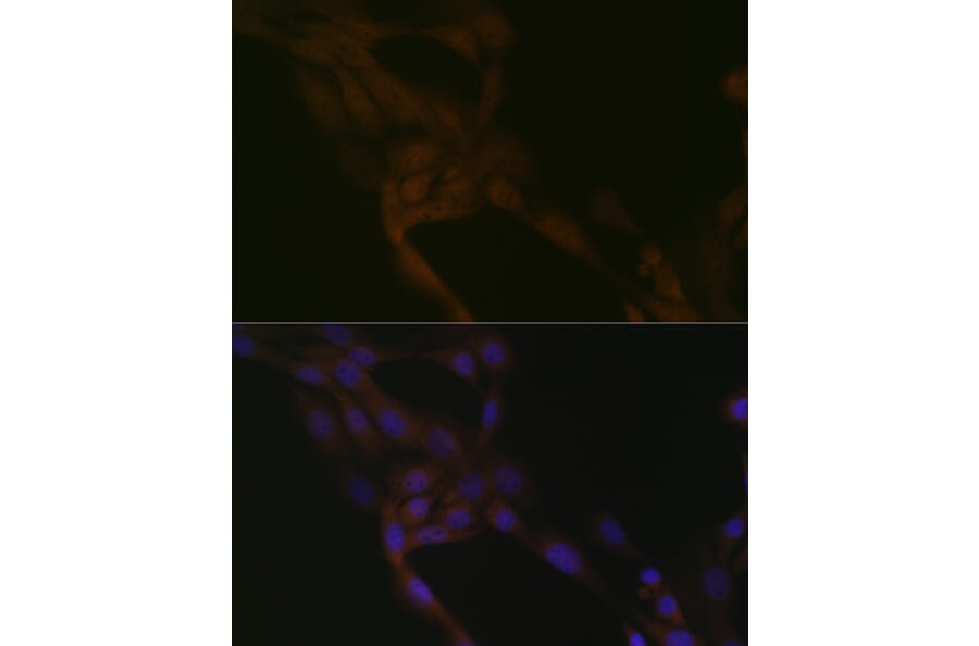 Immunofluorescence - Anti-SMURF 2 Antibody [ARC1897] (A308190) - Antibodies.com