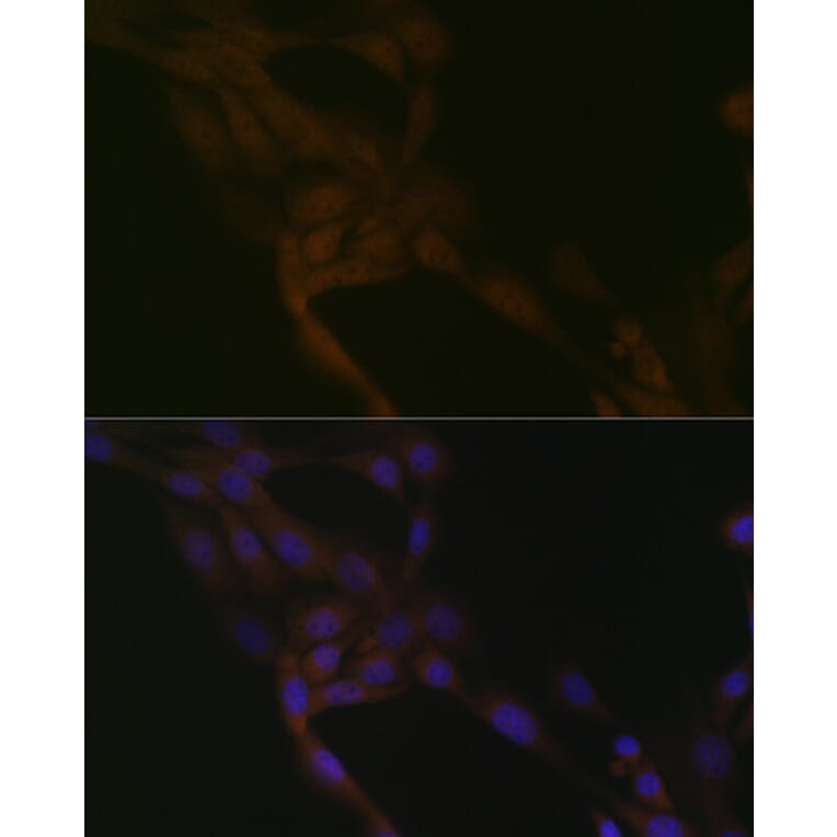 Immunofluorescence - Anti-SMURF 2 Antibody [ARC1897] (A308190) - Antibodies.com