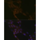 Immunofluorescence - Anti-SMURF 2 Antibody [ARC1897] (A308190) - Antibodies.com