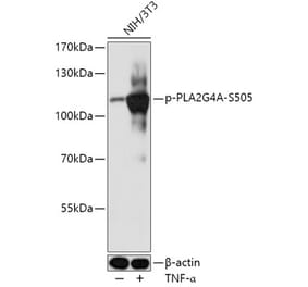 Western Blot - Anti-Cytosolic phospholipase A2 (phospho Ser505) Antibody (A308191) - Antibodies.com