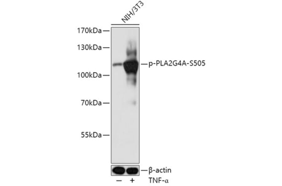 Western Blot - Anti-Cytosolic phospholipase A2 (phospho Ser505) Antibody (A308191) - Antibodies.com