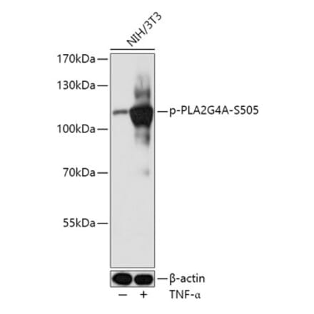 Western Blot - Anti-Cytosolic phospholipase A2 (phospho Ser505) Antibody (A308191) - Antibodies.com