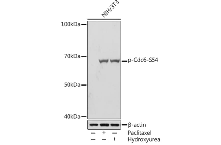 Western Blot - Anti-Cdc6 (phospho Ser54) Antibody [ARC1693] (A308192) - Antibodies.com