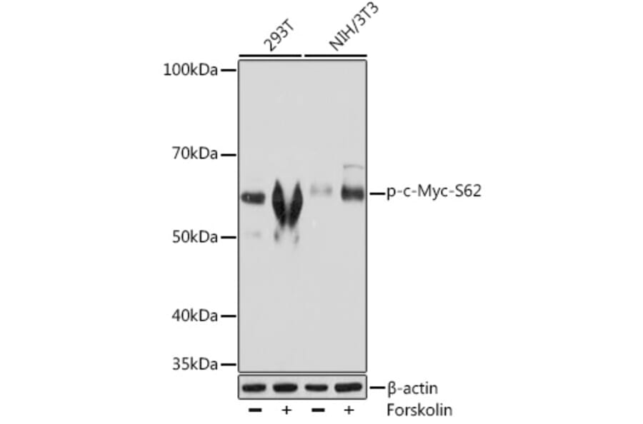 Western Blot - Anti-c-Myc (phospho Ser62) Antibody [ARC1533] (A308193) - Antibodies.com