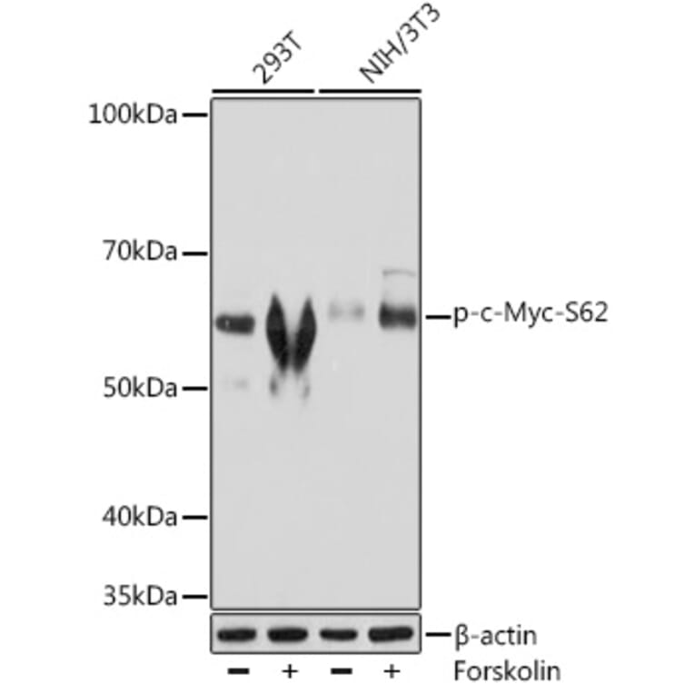 Western Blot - Anti-c-Myc (phospho Ser62) Antibody [ARC1533] (A308193) - Antibodies.com