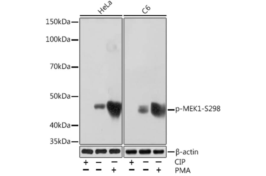 Western Blot - Anti-MEK1 (phospho Ser298) Antibody [ARC1565] (A308195) - Antibodies.com