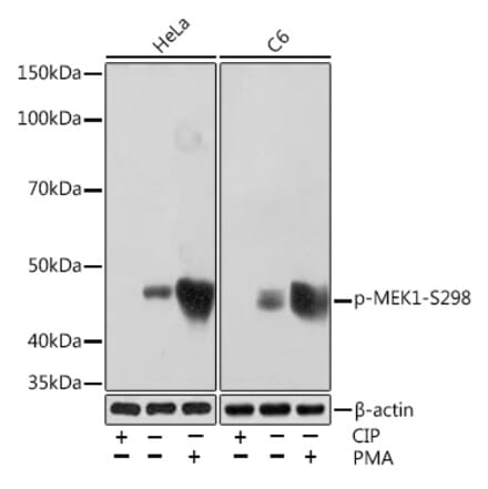Western Blot - Anti-MEK1 (phospho Ser298) Antibody [ARC1565] (A308195) - Antibodies.com