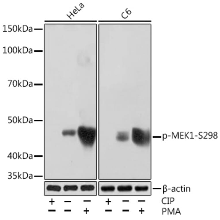 Western Blot - Anti-MEK1 (phospho Ser298) Antibody [ARC1565] (A308195) - Antibodies.com