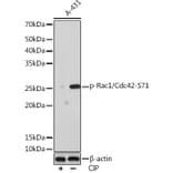 Western Blot - Anti-CDC42 + Rac1 (phospho Ser71) Antibody [ARC1563] (A308196) - Antibodies.com