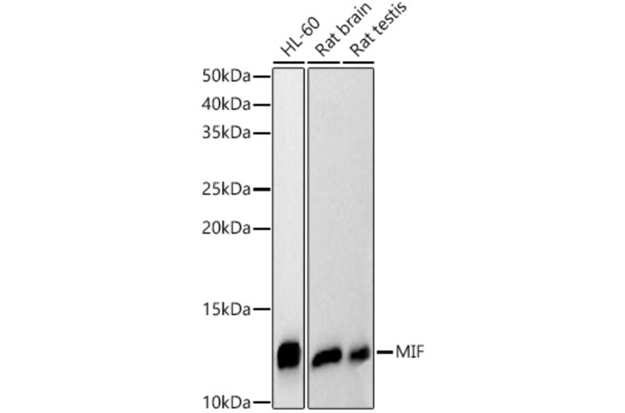 Western Blot - Anti-MIF Antibody (A308197) - Antibodies.com