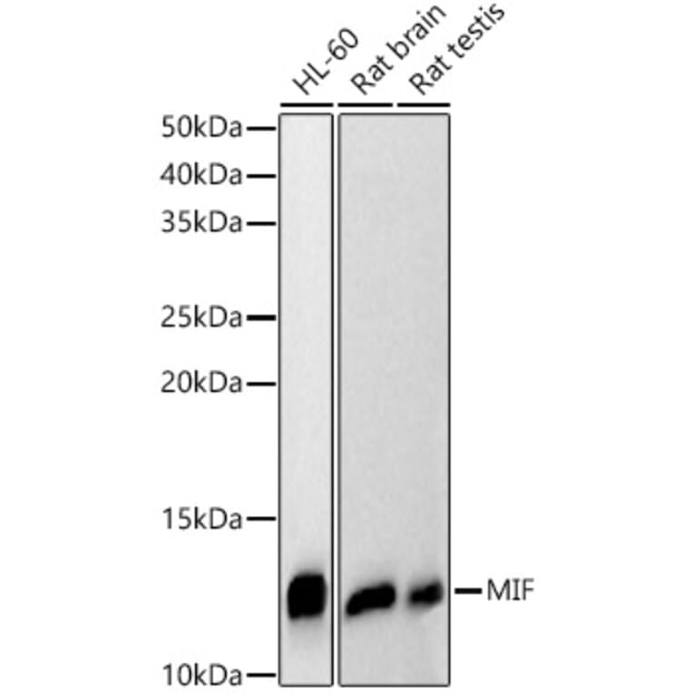 Western Blot - Anti-MIF Antibody (A308197) - Antibodies.com