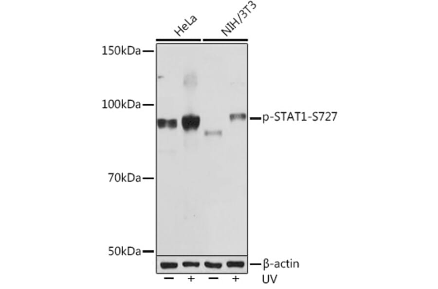 Western Blot - Anti-STAT1 (phospho Ser727) Antibody [ARC1544] (A308199) - Antibodies.com