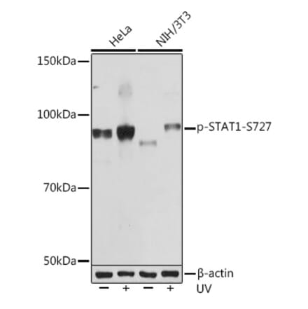 Western Blot - Anti-STAT1 (phospho Ser727) Antibody [ARC1544] (A308199) - Antibodies.com