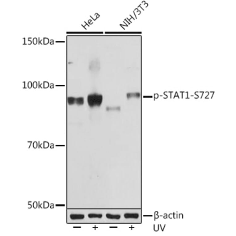 Western Blot - Anti-STAT1 (phospho Ser727) Antibody [ARC1544] (A308199) - Antibodies.com