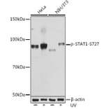 Western Blot - Anti-STAT1 (phospho Ser727) Antibody [ARC1544] (A308199) - Antibodies.com