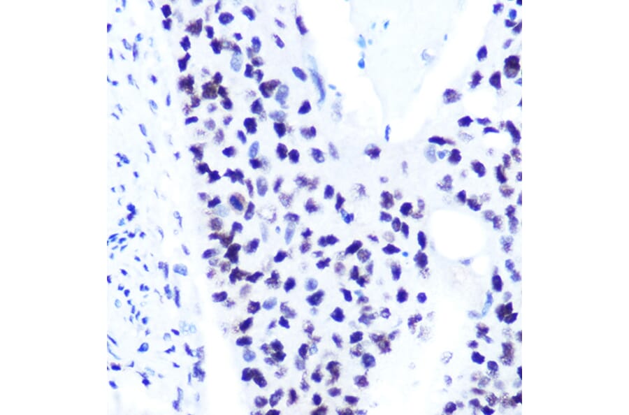 Immunohistochemistry - Anti-STAT1 (phospho Ser727) Antibody [ARC1544] (A308199) - Antibodies.com
