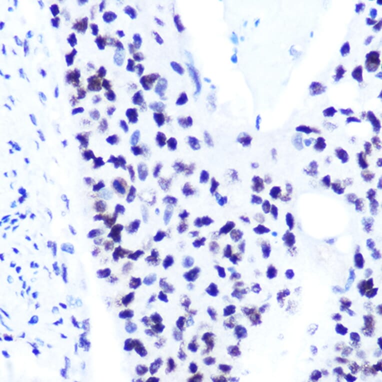 Immunohistochemistry - Anti-STAT1 (phospho Ser727) Antibody [ARC1544] (A308199) - Antibodies.com