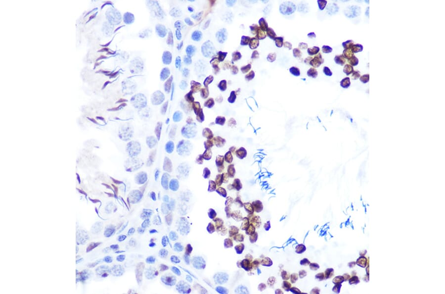 Immunohistochemistry - Anti-STAT1 (phospho Ser727) Antibody [ARC1544] (A308199) - Antibodies.com