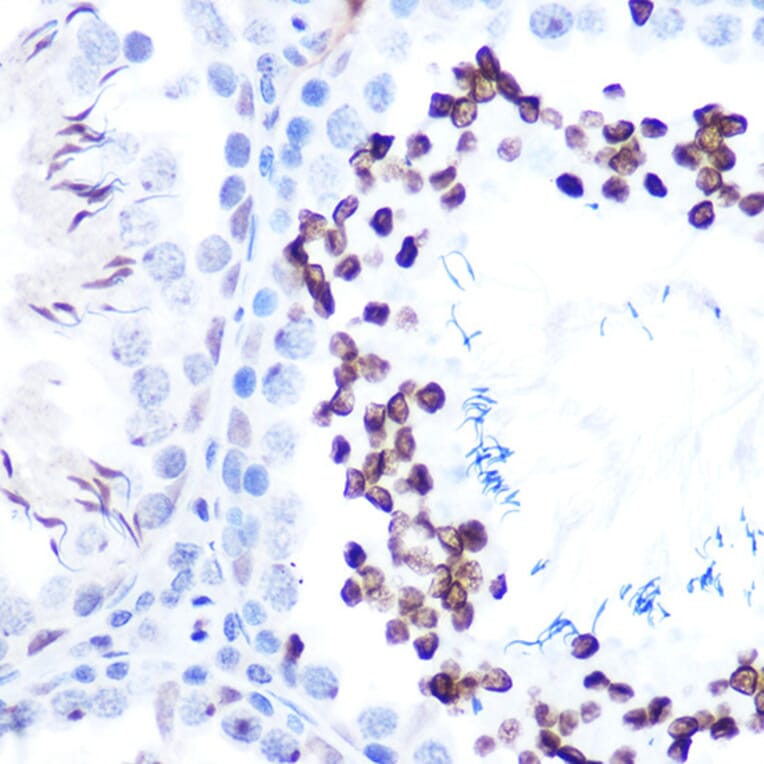 Immunohistochemistry - Anti-STAT1 (phospho Ser727) Antibody [ARC1544] (A308199) - Antibodies.com