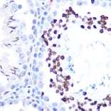 Immunohistochemistry - Anti-STAT1 (phospho Ser727) Antibody [ARC1544] (A308199) - Antibodies.com