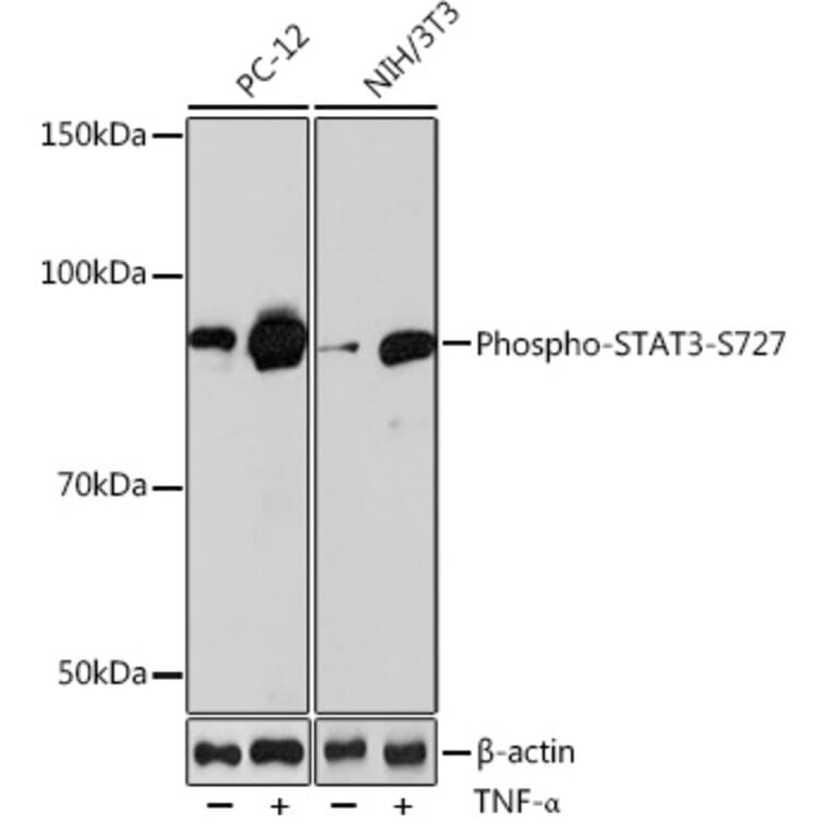 Western Blot - Anti-STAT3 (phospho Ser727) Antibody [ARC0150] (A308200) - Antibodies.com