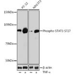 Western Blot - Anti-STAT3 (phospho Ser727) Antibody [ARC0150] (A308200) - Antibodies.com