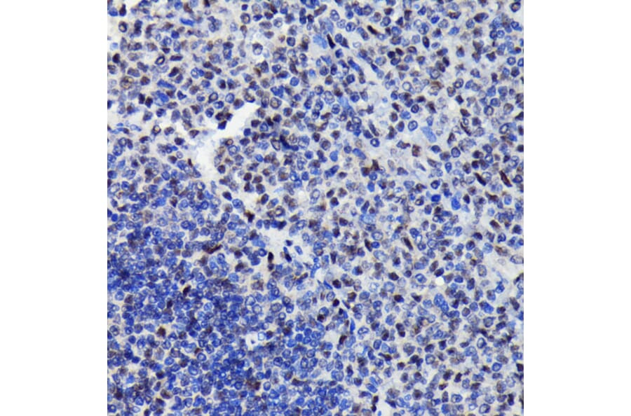 Immunohistochemistry - Anti-STAT3 (phospho Ser727) Antibody (A308200) - Antibodies.com