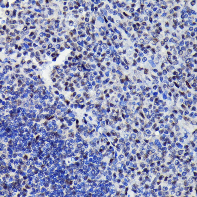 Immunohistochemistry - Anti-STAT3 (phospho Ser727) Antibody (A308200) - Antibodies.com