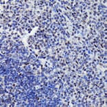 Immunohistochemistry - Anti-STAT3 (phospho Ser727) Antibody (A308200) - Antibodies.com