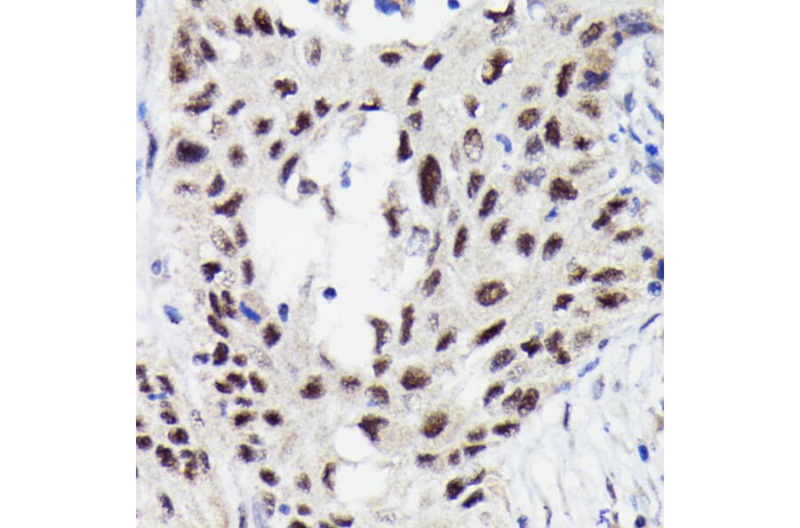 Immunohistochemistry - Anti-STAT3 (phospho Ser727) Antibody [ARC0150] (A308200) - Antibodies.com