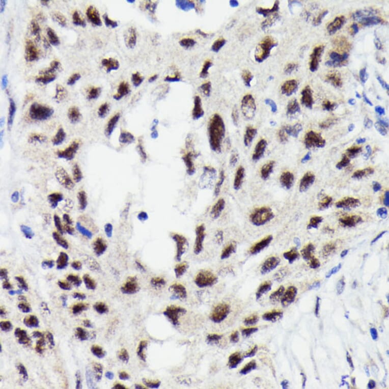 Immunohistochemistry - Anti-STAT3 (phospho Ser727) Antibody [ARC0150] (A308200) - Antibodies.com