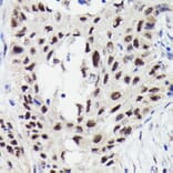 Immunohistochemistry - Anti-STAT3 (phospho Ser727) Antibody [ARC0150] (A308200) - Antibodies.com