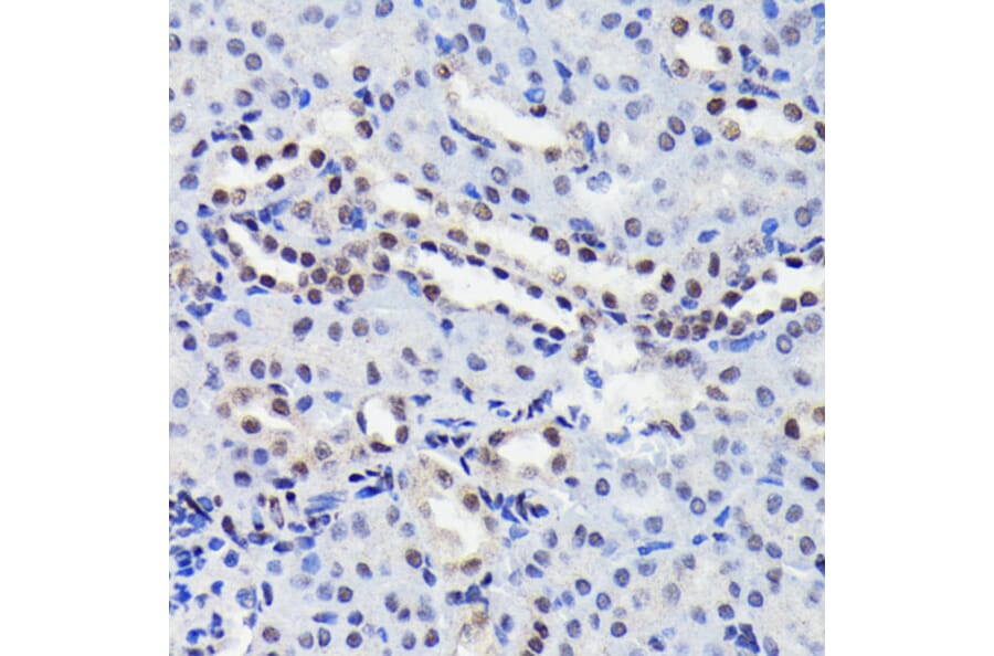 Immunohistochemistry - Anti-STAT3 (phospho Ser727) Antibody [ARC0150] (A308200) - Antibodies.com