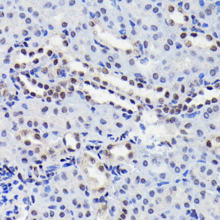 Immunohistochemistry - Anti-STAT3 (phospho Ser727) Antibody [ARC0150] (A308200) - Antibodies.com