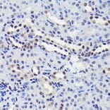 Immunohistochemistry - Anti-STAT3 (phospho Ser727) Antibody [ARC0150] (A308200) - Antibodies.com