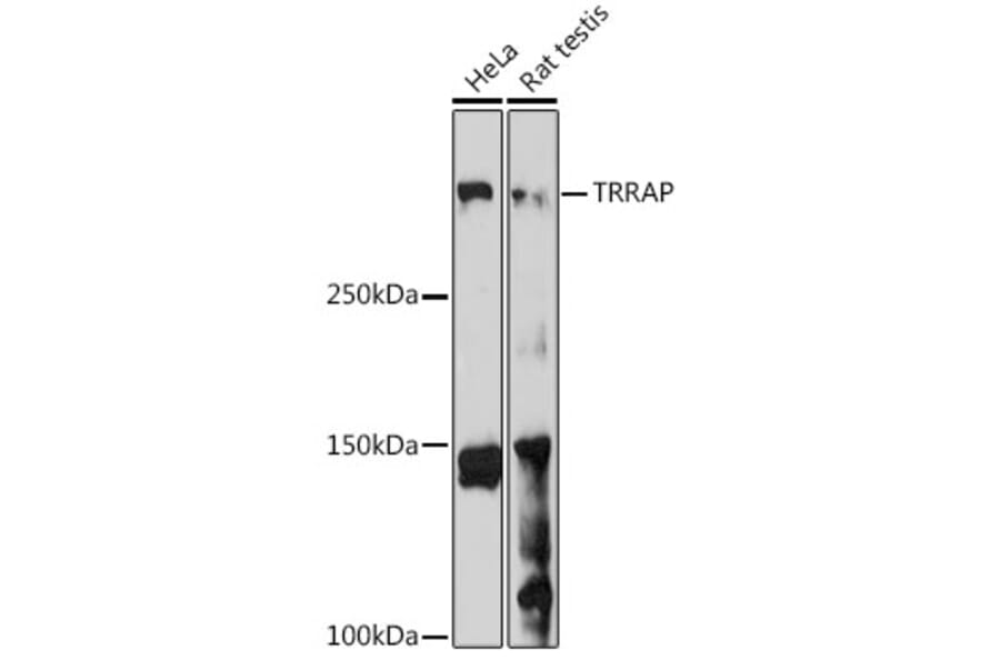 Western Blot - Anti-TRRAP Antibody (A308201) - Antibodies.com