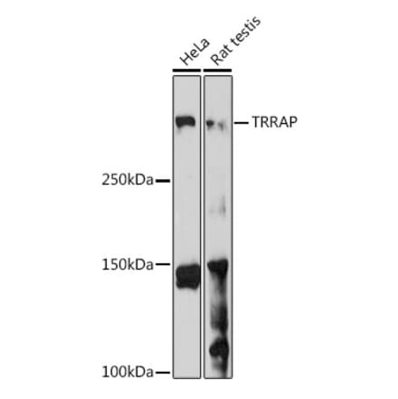 Western Blot - Anti-TRRAP Antibody (A308201) - Antibodies.com