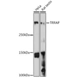 Western Blot - Anti-TRRAP Antibody (A308201) - Antibodies.com