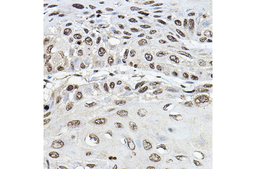 Immunohistochemistry - Anti-TRRAP Antibody (A308201) - Antibodies.com