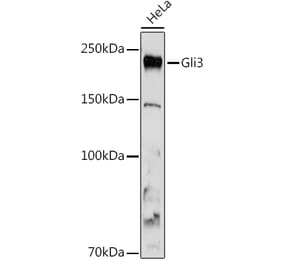 Western Blot - Anti-Gli3 Antibody [ARC1941] (A308202) - Antibodies.com