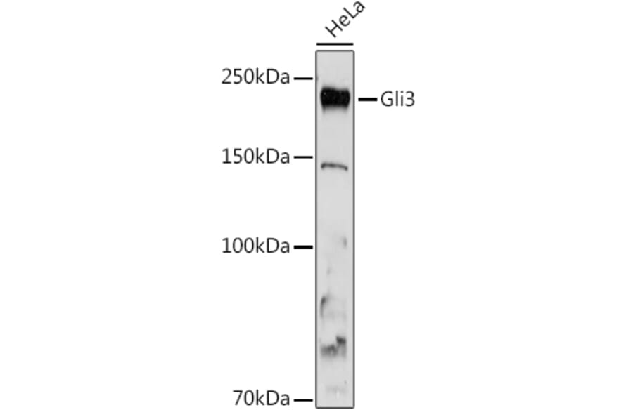 Western Blot - Anti-Gli3 Antibody [ARC1941] (A308202) - Antibodies.com
