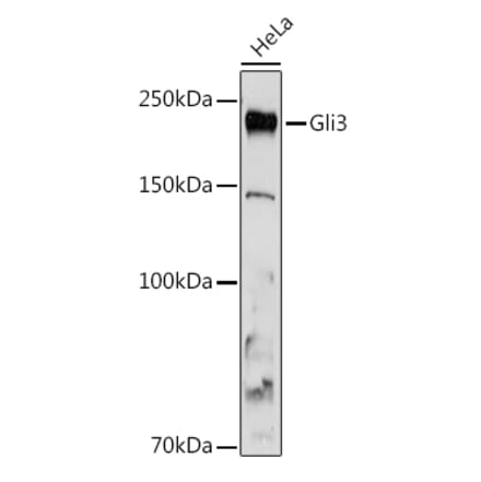 Western Blot - Anti-Gli3 Antibody [ARC1941] (A308202) - Antibodies.com