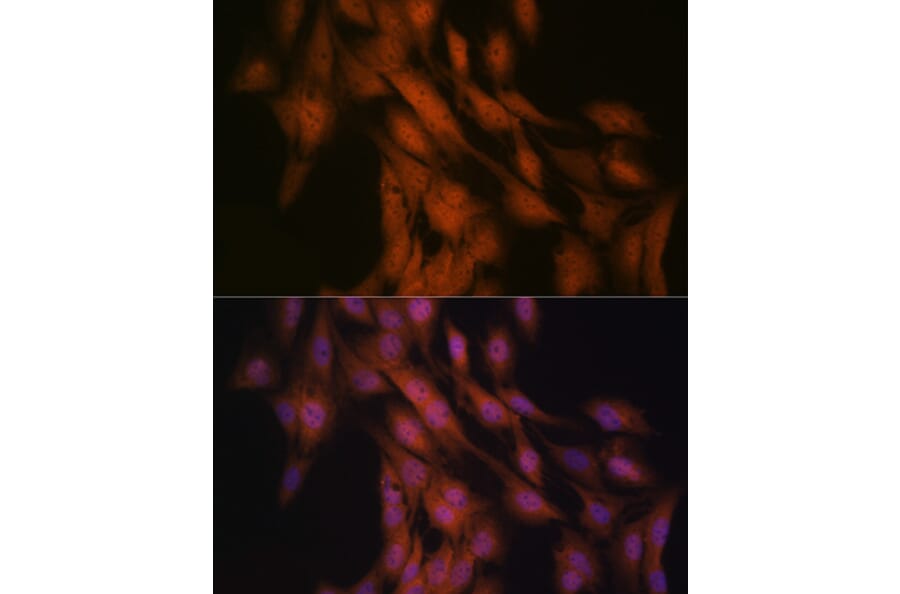 Immunofluorescence - Anti-Gli3 Antibody [ARC1941] (A308202) - Antibodies.com