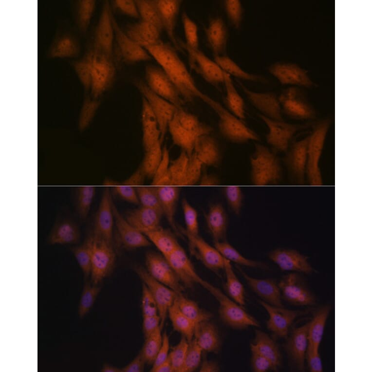 Immunofluorescence - Anti-Gli3 Antibody [ARC1941] (A308202) - Antibodies.com