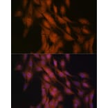 Immunofluorescence - Anti-Gli3 Antibody [ARC1941] (A308202) - Antibodies.com