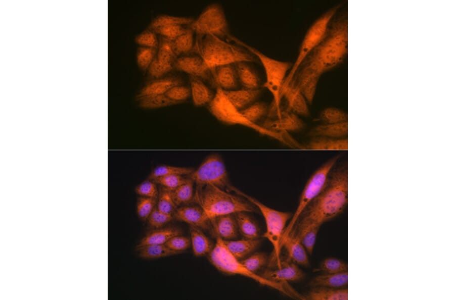Immunofluorescence - Anti-Gli3 Antibody [ARC1941] (A308202) - Antibodies.com